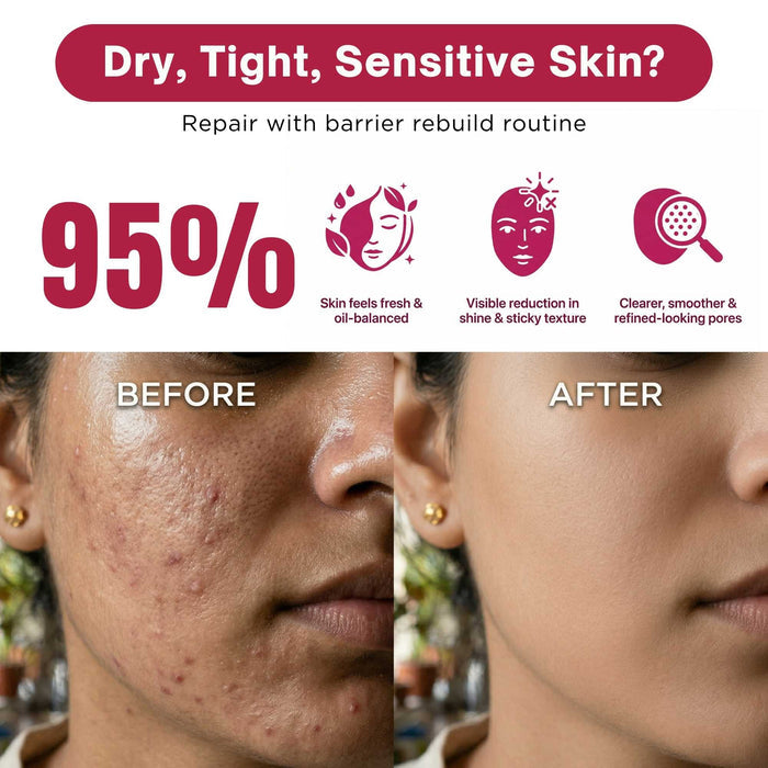 Oil Control Balance Regime – Pore Refining Care