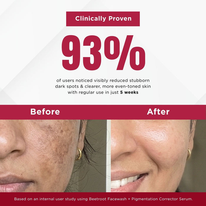 Stuborn Dark Spots 3 Steps - Facewash+Serums - The Skin Story -