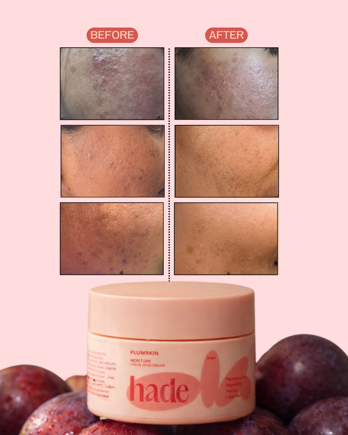 PLUMSKIN